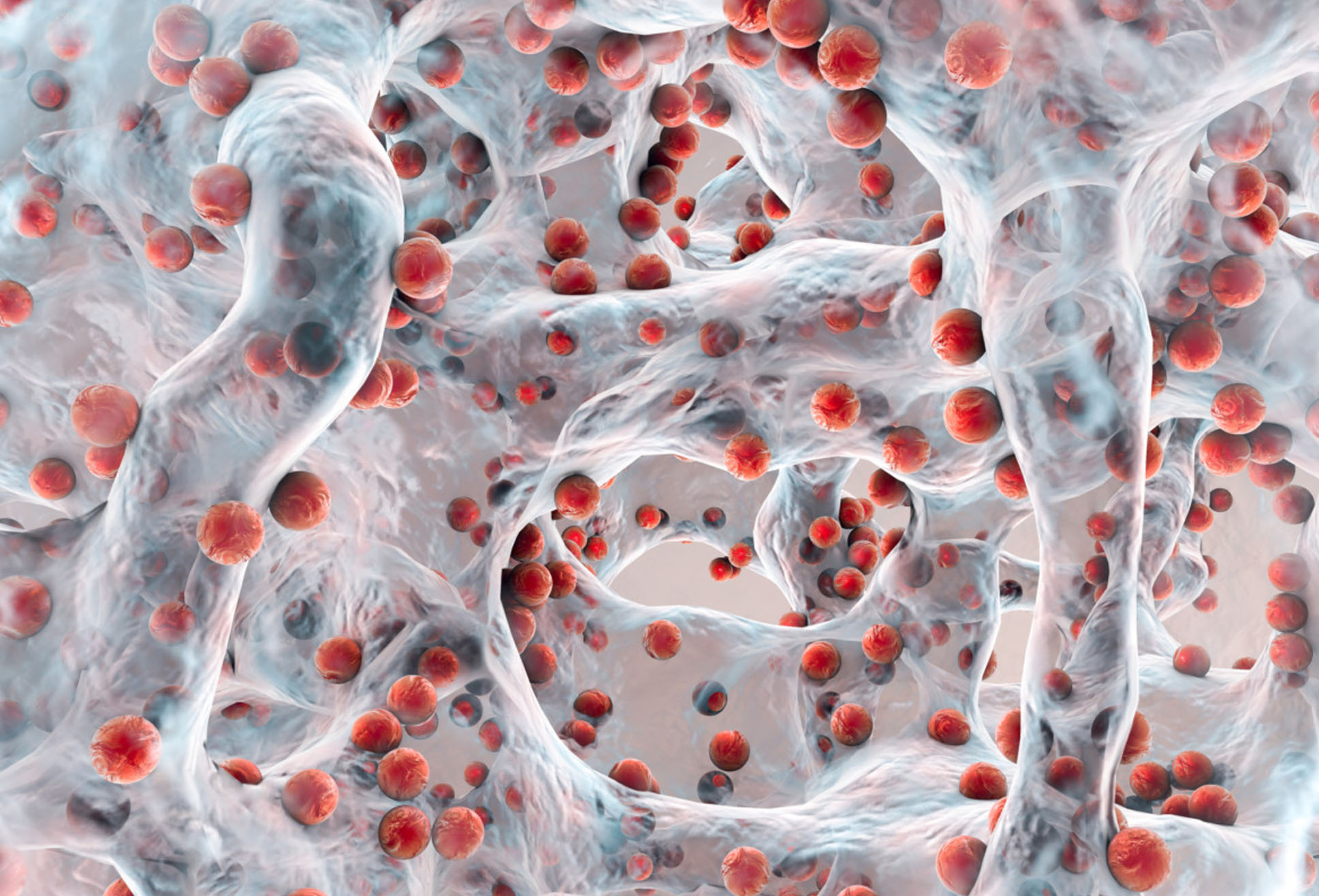 Peroxsil Ag+ - Biofilm